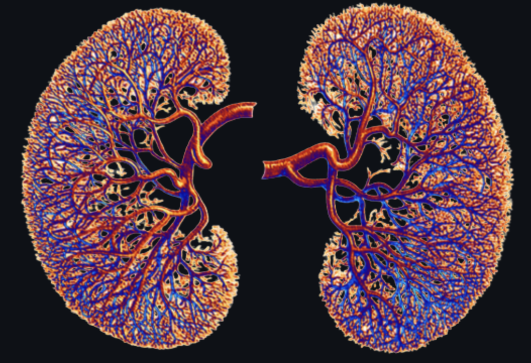 CKD